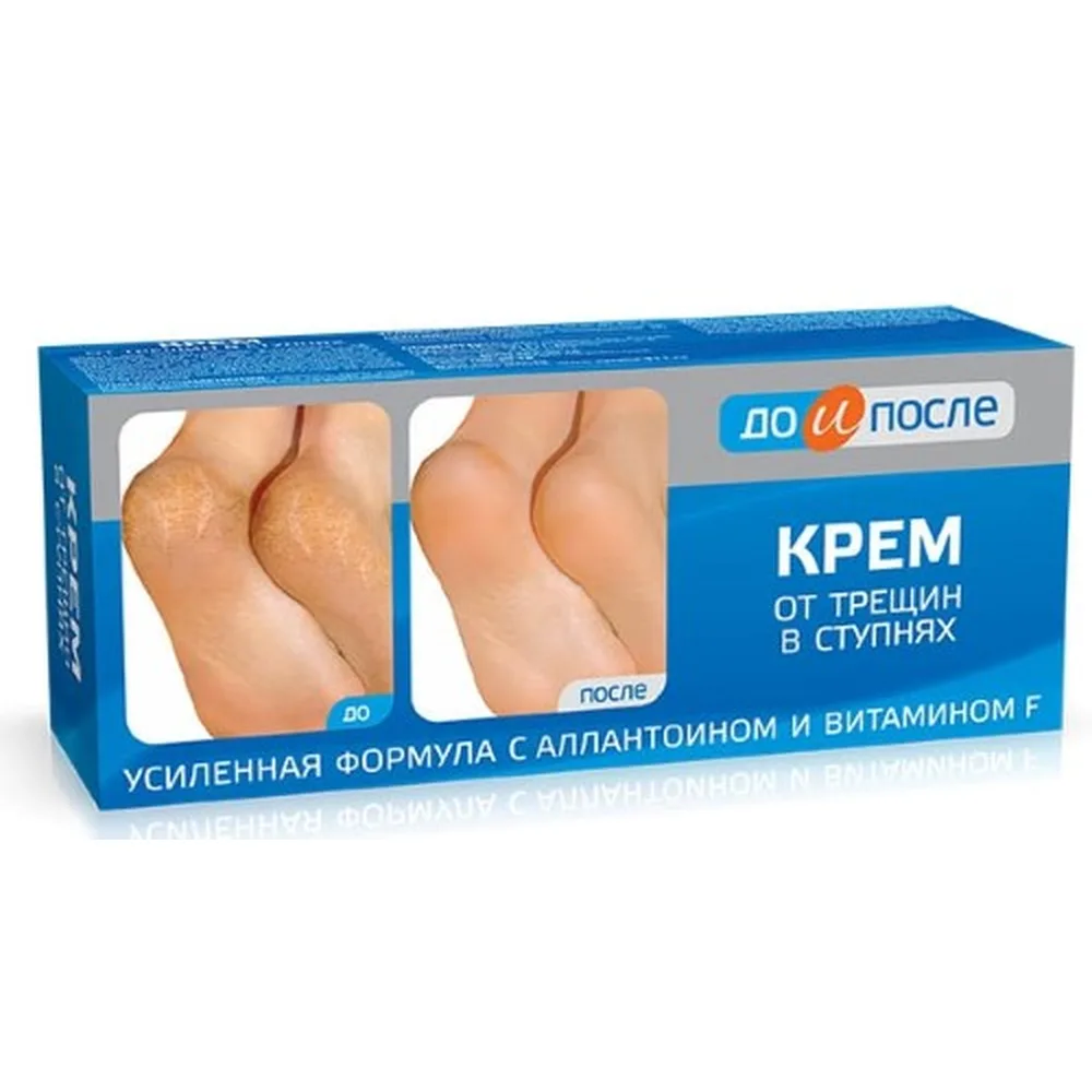 Before and After Cream for Cracked Heels 50 ml