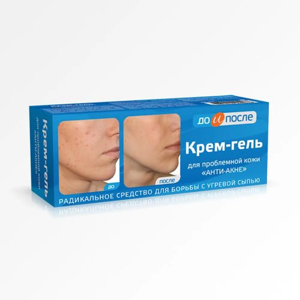 Do and After Anti-Acne Cream-Gel for Problematic Skin 50 ml